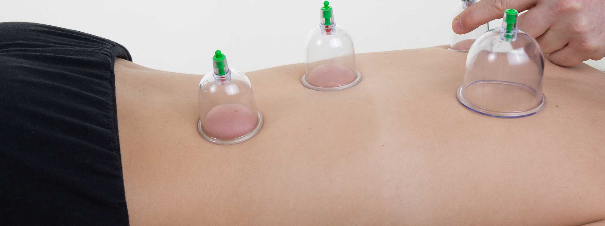 Hijama and Cupping Course